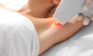Θυλακίτιδα και Laser Αποτρίχωση